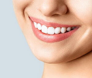 Invisalign: Straighten Your Teeth Discreetly